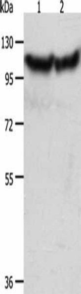 ACTN3 Antibody (PACO15283)