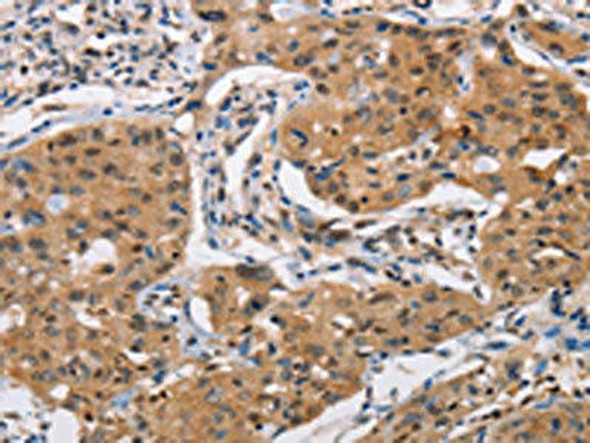 PRKAA2 Antibody (PACO15430)