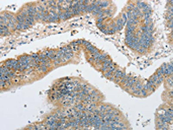 ARHGEF9 Antibody (PACO15519)