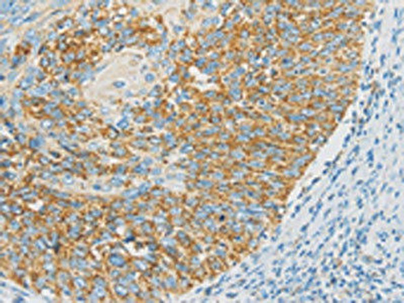 IDH3G Antibody (PACO15574)
