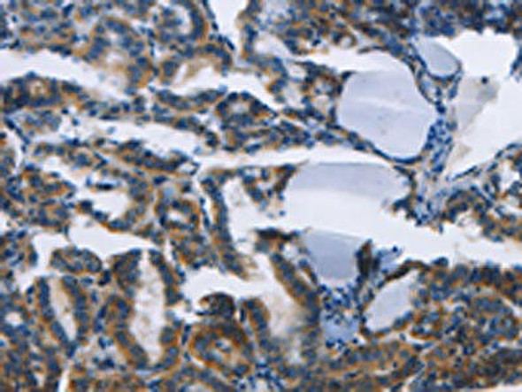 TWF2 Antibody (PACO15658)