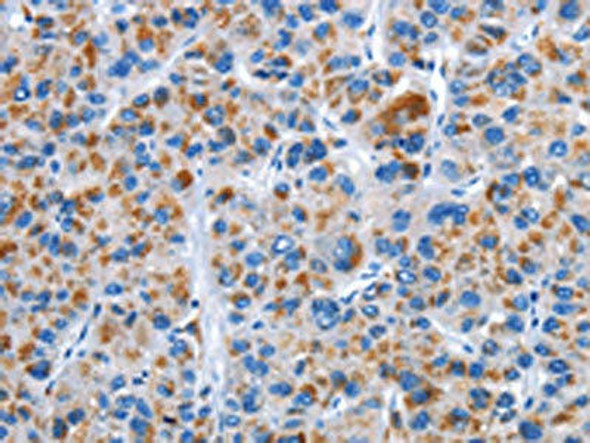 CENPJ Antibody (PACO16011)