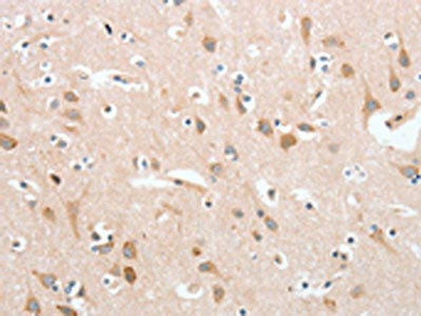 PLA2G4A Antibody (PACO16065)