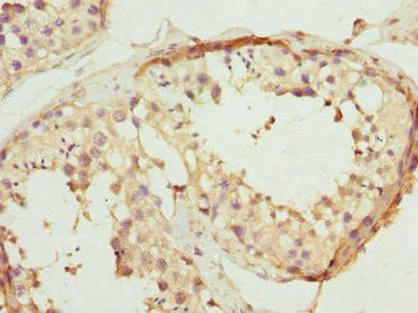 PTPRB Antibody (PACO44479)