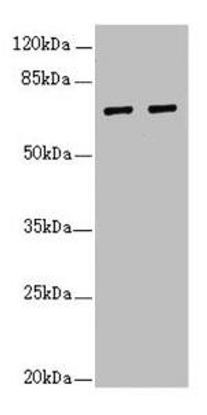 IWS1 Antibody (PACO44645)
