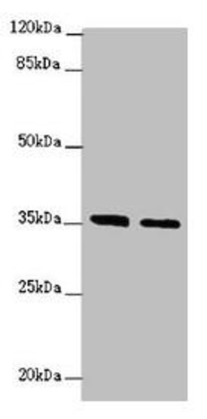 OSGEP Antibody (PACO44668)