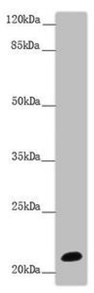 NCALD Antibody (PACO44957)