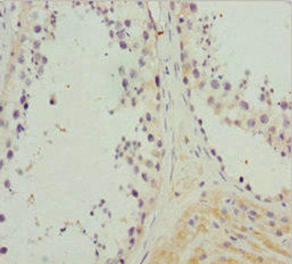 NCALD Antibody (PACO44958)