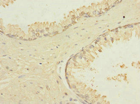 TRPM4 Antibody (PACO45305)