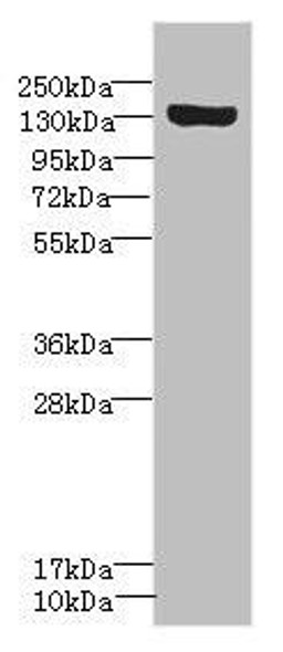 SCN8A Antibody (PACO45476)