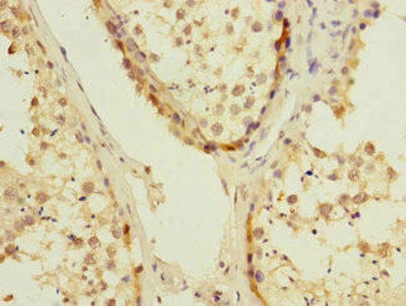 UBE2S Antibody (PACO45538)