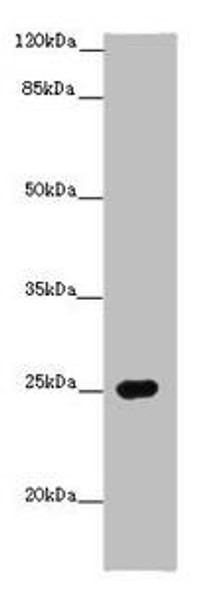 PRG2 Antibody (PACO46126)