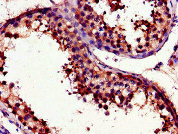 UNG Antibody (PACO47738)