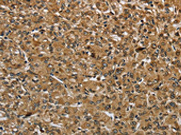 IKBIP Antibody (PACO16531)