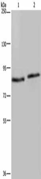 ITGB2 Antibody (PACO16555)