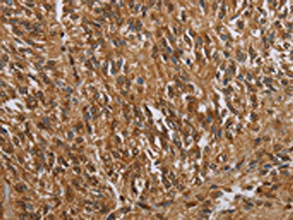 KARS Antibody (PACO16576)