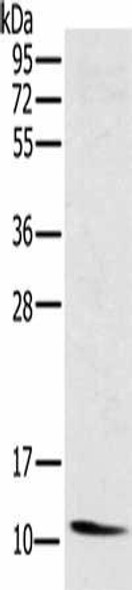 NDUFA3 Antibody (PACO16752)