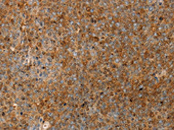 SERPINB2 Antibody (PACO16832)