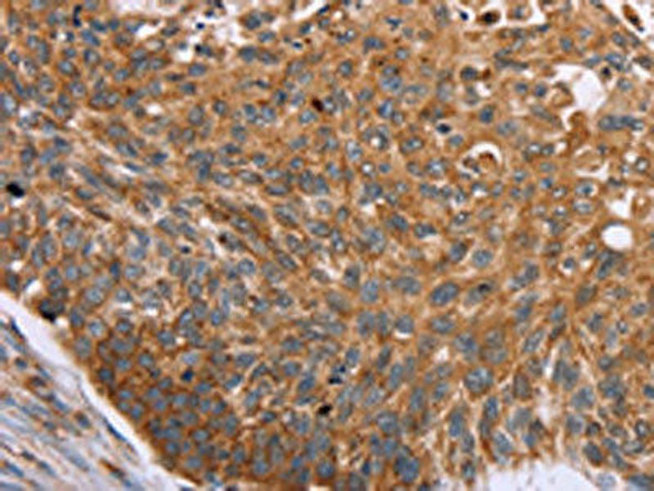 PMPCB Antibody (PACO16881)