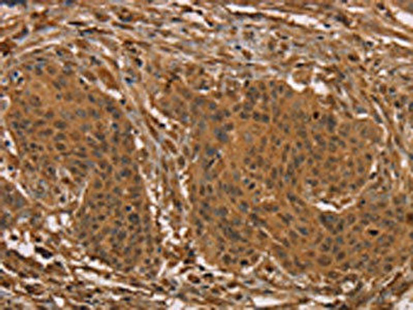 PRC1 Antibody (PACO16894)