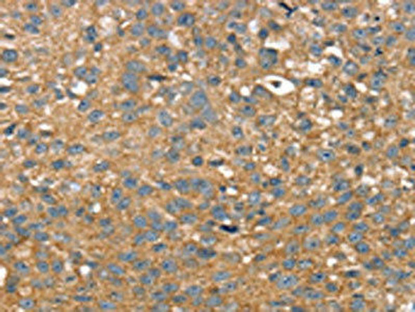 TWF1 Antibody (PACO16901)