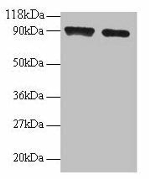 SAT1 Antibody (PACO31548)