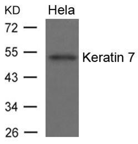 KRT7 Antibody (PACO21536)