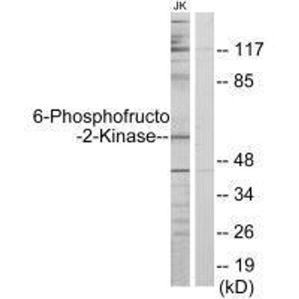 PFKFB2 Antibody (PACO21696)
