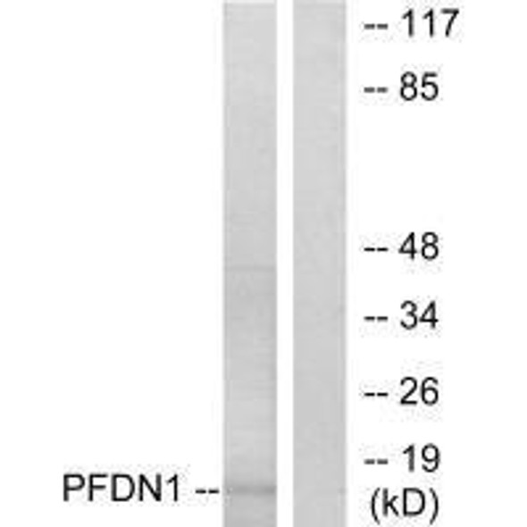 PFDN1 Antibody (PACO21697)