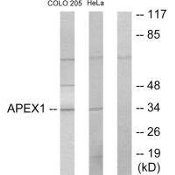 APEX1 Antibody (PACO21760)