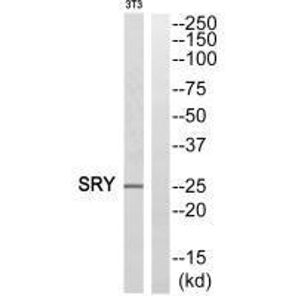 SRY Antibody (PACO21830)