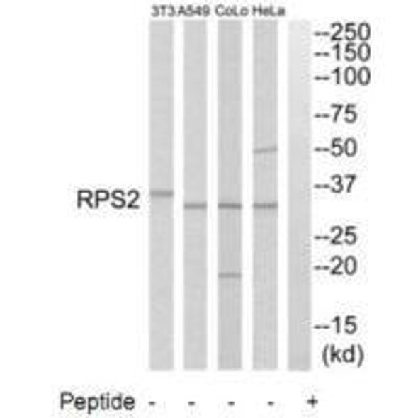 RPS2 Antibody (PACO22094)