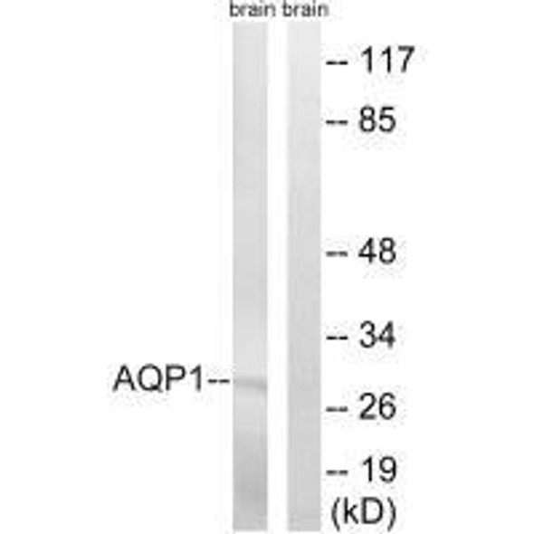 AQP1 Antibody (PACO22154)