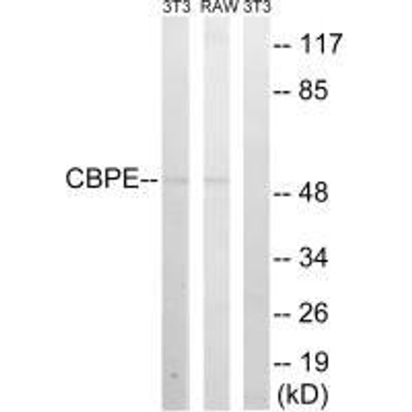 CPE Antibody (PACO22238)