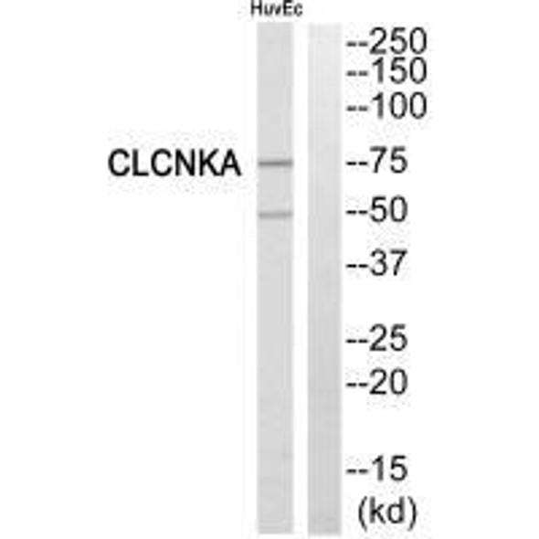 CLCNKA Antibody (PACO22263)