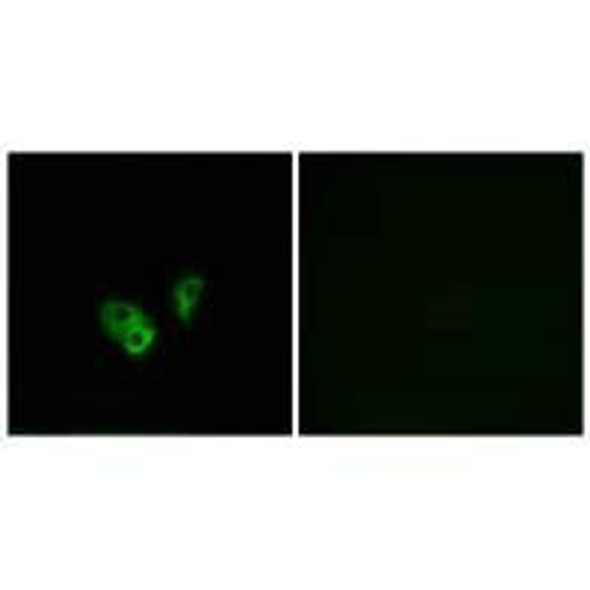 CNGA2 Antibody (PACO22291)