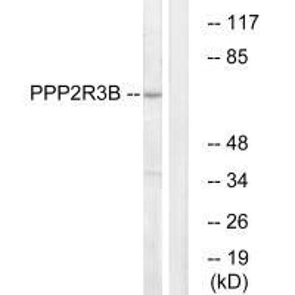 PPP2R3B Antibody (PACO22601)