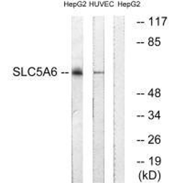 SLC5A6 Antibody (PACO22623)