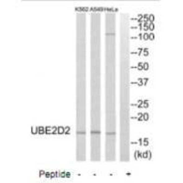 UBE2D2 Antibody (PACO22679)