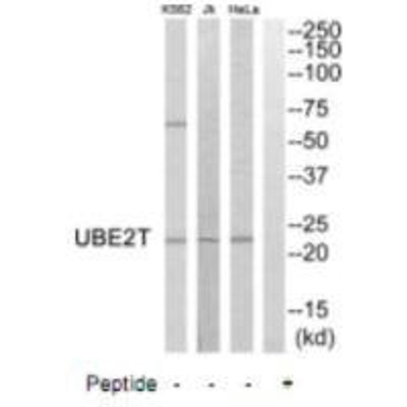 UBE2T Antibody (PACO22680)