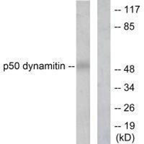 DCTN2 Antibody (PACO23130)