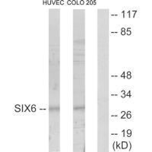 SIX6 Antibody (PACO23182)