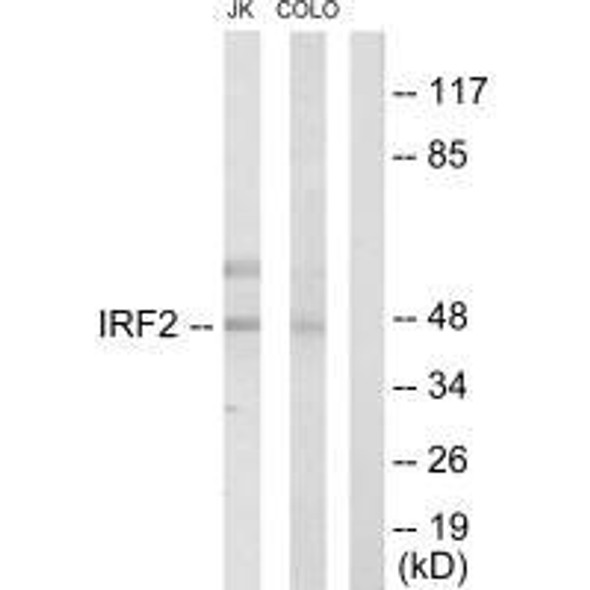 IRF2 Antibody (PACO23197)