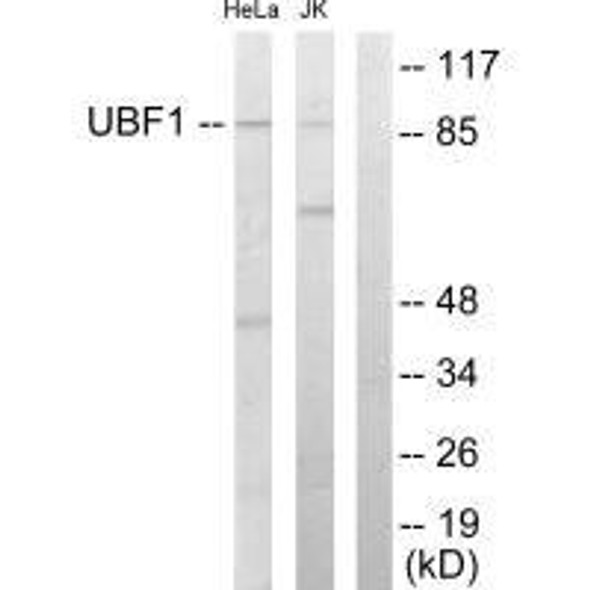 UBTF Antibody (PACO23200)