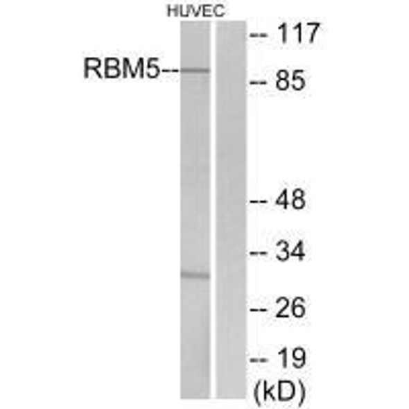 RBM5 Antibody (PACO23230)