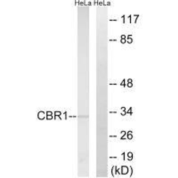 CBR1 Antibody (PACO23406)