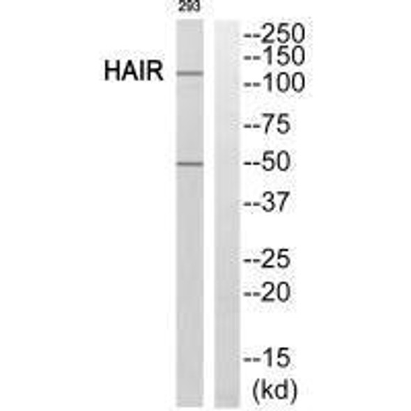 HR Antibody (PACO23725)