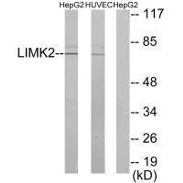 LIMK2 Antibody (PACO23746)