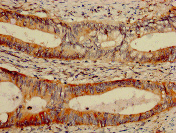 LGALS7 Antibody (PACO32728)