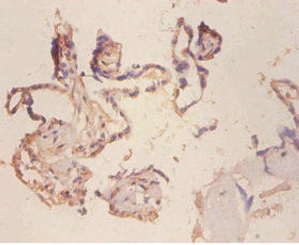 MCAM Antibody (PACO32848)